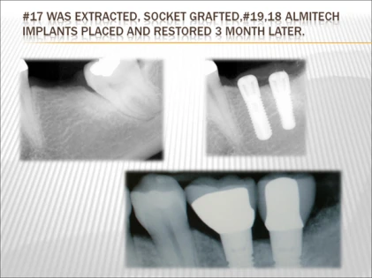 Almitech (4.8)